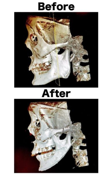 Repezen Foxx(元レペゼン地球)DJ社長整形したってホント？どこを整形したの？比較してみた