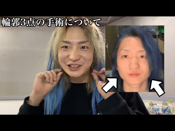 Repezen Foxx(元レペゼン地球)DJ社長整形したってホント？どこを整形したの？比較してみた