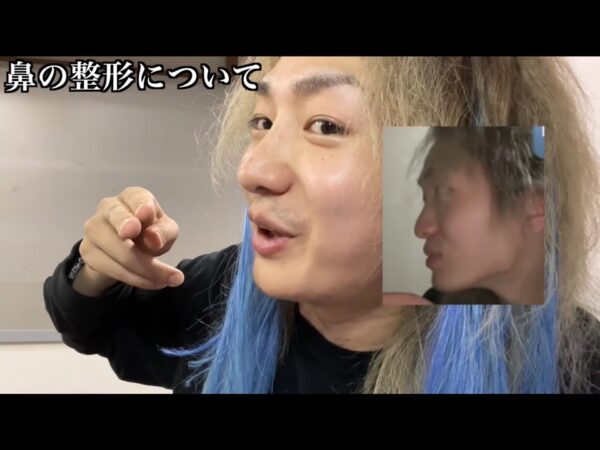 Repezen Foxx(元レペゼン地球)DJ社長整形したってホント？どこを整形したの？比較してみた