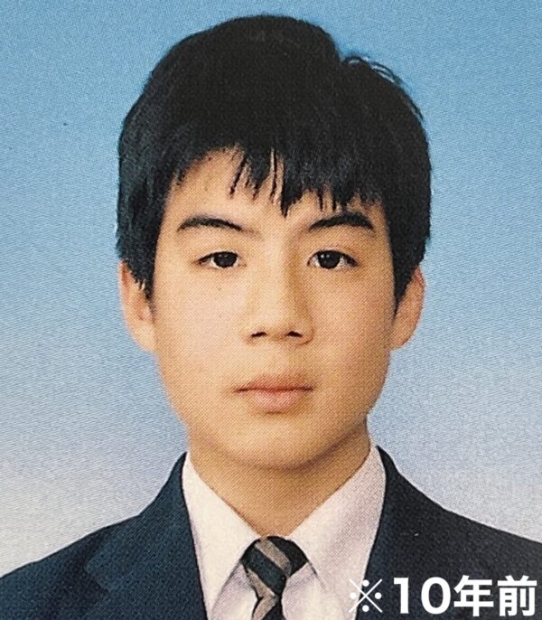 フィッシャーズ・モトキがうつ病を告白！原因は幼少期にも？