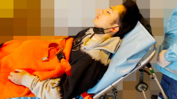 フィッシャーズ・シルクが大けが！過去には救急搬送されていた？