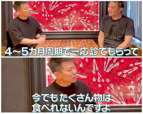 宮迫ですッ (宮迫博之)スキルス胃がんの経験を語る！再発や余命についても言及？