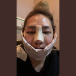 Repezen Foxx(元レペゼン地球)DJ社長整形したってホント?どこを整形したの?比較してみた